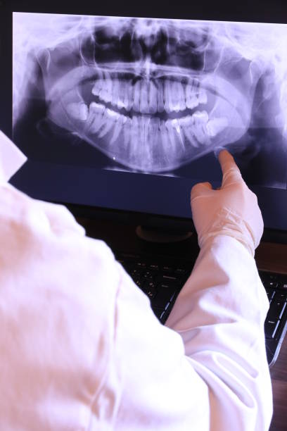 Best Emergency Wisdom Tooth Extraction in San Augustine, TX