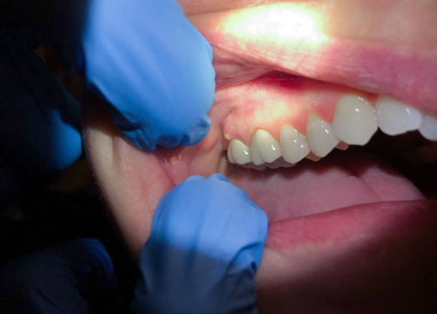 Best Emergency Root Canal Therapy in San Augustine, TX